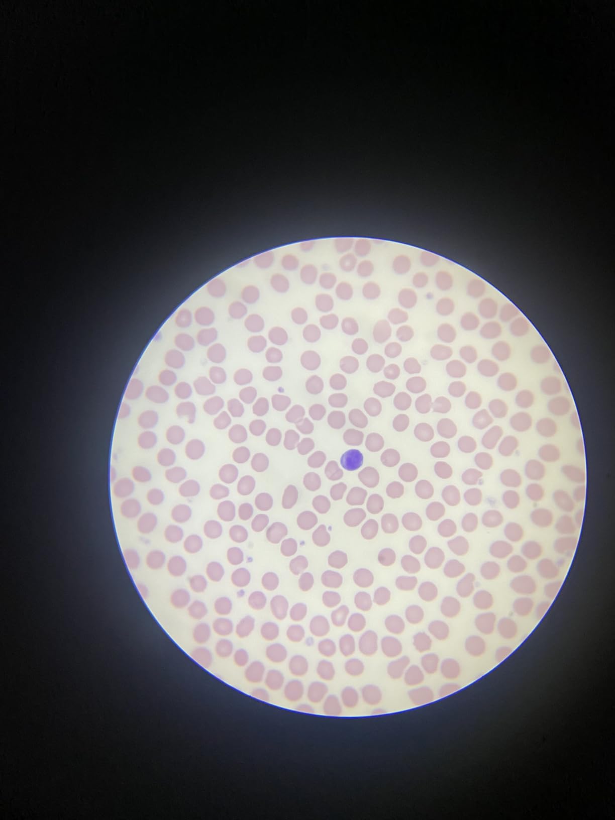 Smartphone Telescope Adapter Camera Mount, Universal Phone Mount, Work with Telescope Spotting Scope Microscope Monocular Binocular - Fits iPhone, Samsung, HTC, LG and Smartphone Customer Review Smartphone Telescope Adapter Camera Mount, Universal Phone Mount, Work with Telescope Spotting Scope Microscope Monocular Binocular - Fits iPhone, Samsung, HTC, LG and Smartphone - Customer Photo 2