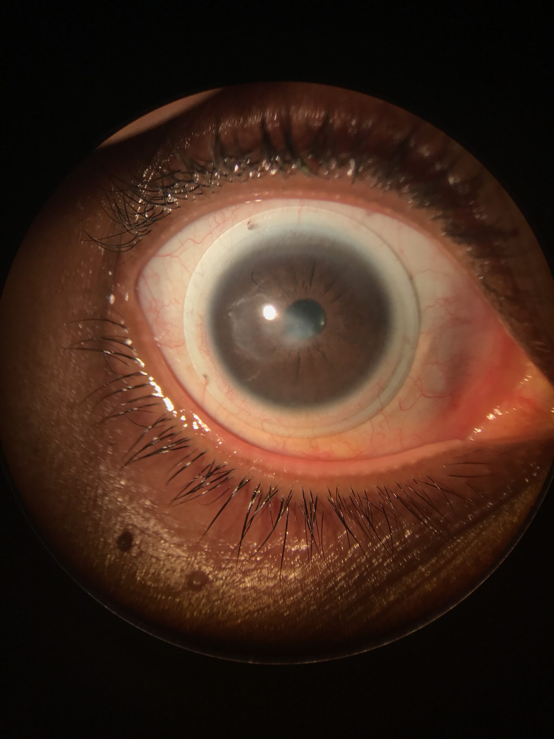 LUXUN Universal Cell Phone Photography Adapter Smart Phone Adapter Mount-Quick Smartphone Adapter Holder Clip Bracket for Binoculars Telescope Monocular Spotting Scope Microscope Accessories Customer Review LUXUN Universal Cell Phone Photography Adapter Smart Phone Adapter Mount-Quick Smartphone Adapter Holder Clip Bracket for Binoculars Telescope Monocular Spotting Scope Microscope Accessories - Customer Photo 1