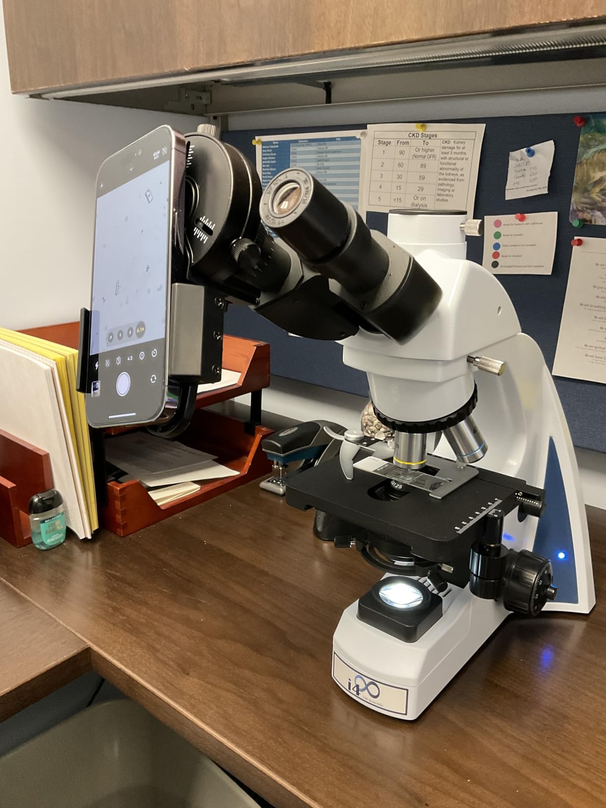 Upgrade Smartphone Scope Adapter Spotting Scope Phone Adapter - Telescope Phone Mount for Spotting Scopes & Binoculars & Monocular & Telescope & Microscope Customer Review Upgrade Smartphone Scope Adapter Spotting Scope Phone Adapter - Telescope Phone Mount for Spotting Scopes & Binoculars & Monocular & Telescope & Microscope - Customer Photo 1